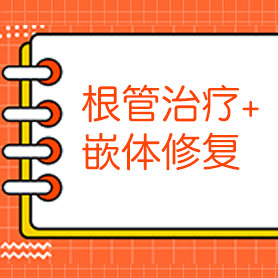 协尔周秀 | 根管治疗+嵌体修复一例